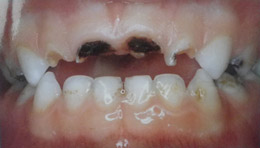 Παιδοδοντίατρος Βίκυ Ορ. Τασιούλα Οδοντίατρος Α.Π.Θ., ειδικευθείσα στην Παιδοδοντιατρική M Dent Sci Leeds Dental Institute, UK | Οδοντίατρος για παιδιά, εφήβους και ειδικούς ασθενείς | Πάροδος Γ. Ολυμπίου 1, 60132 Κατερίνη | Παιδοδοντίατρος στην Κατερίνη, Οδοντίατρος για παιδιά στην Κατερίνη, paidodontiatros katerini