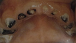 Παιδοδοντίατρος Βίκυ Ορ. Τασιούλα Οδοντίατρος Α.Π.Θ., ειδικευθείσα στην Παιδοδοντιατρική M Dent Sci Leeds Dental Institute, UK | Οδοντίατρος για παιδιά, εφήβους και ειδικούς ασθενείς | Πάροδος Γ. Ολυμπίου 1, 60132 Κατερίνη | Παιδοδοντίατρος στην Κατερίνη, Οδοντίατρος για παιδιά στην Κατερίνη, paidodontiatros katerini